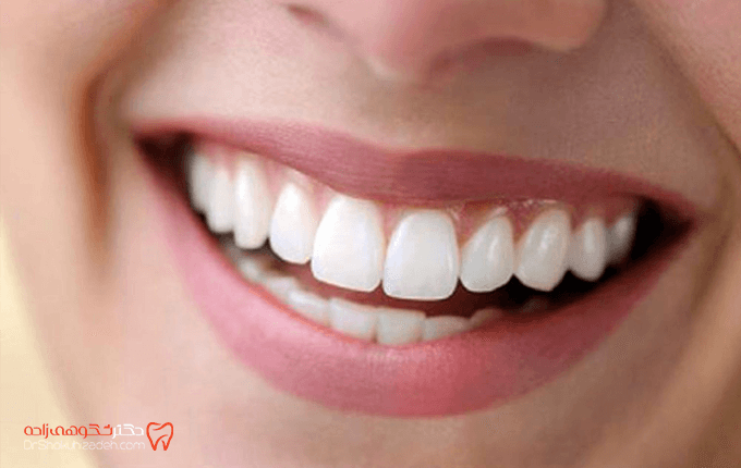 از بین بردن زردی دندان در خانه