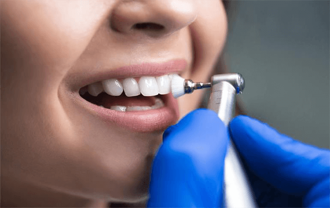 آیا جرم گیری دندان باعث آسیب پذیری و لق شدن دندان می شود؟ 