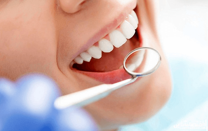 مزایای جرم گیری دندان 