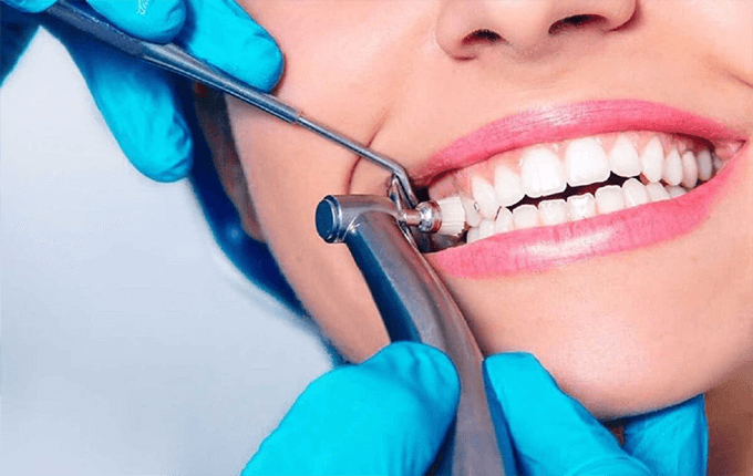 عوارض جرم گیری دندان چیست؟ 