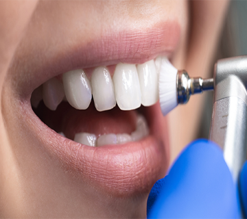 بلیچینگ و جرم گیری دندان چه تفاوتی دارند؟