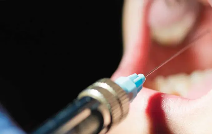 اگر عصب کشی دندان انجام نشود چه اتفاقی می‌افتد؟
