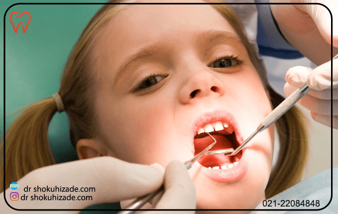 علت خونریزی دندان کودکان چیست؟