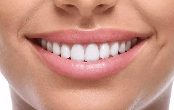 انواع کامپوزیت دندان 