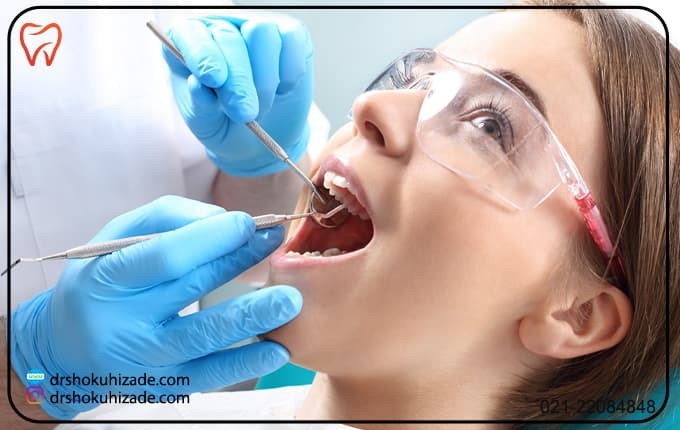 مراقبت های بعد از عصب کشی دندان های جلو